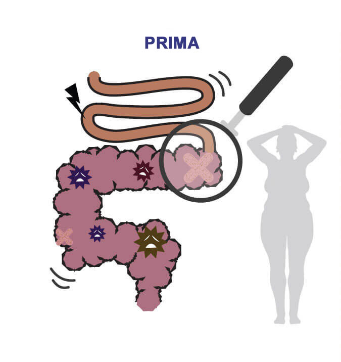 L'intestino è pieno di depositi, non è in grado di bruciare i grassi. Il metabolismo è scarso. L'intestino è pulito e con peristaltica sana. Il metabolismo è sano e la combustione dei grassi è rapida.